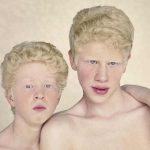 albinos 2