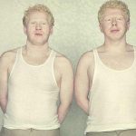 albinos 3