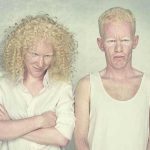 albinos 7