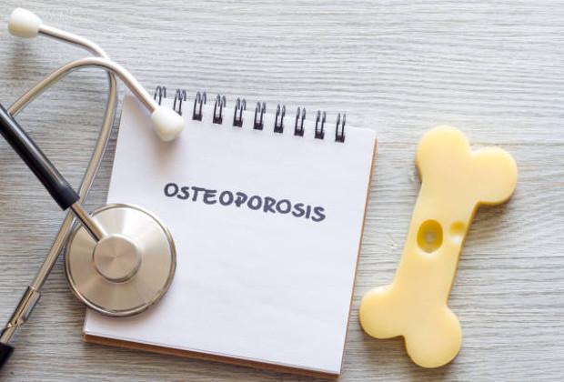 Οστεοπόρωση: Αντιμετώπισέ την με φυσικοθεραπεία και διατροφή!